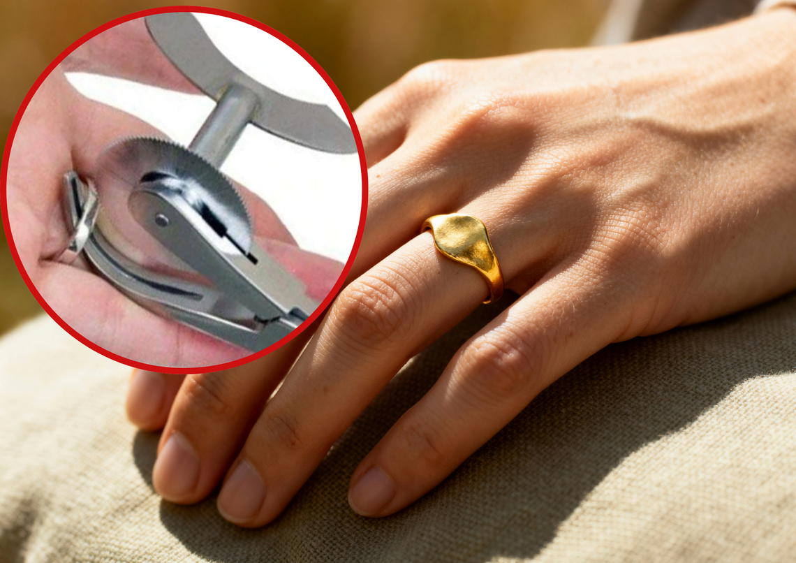 Strażacy OSP Odrowąż podczas nietypowej interwencji polegającej na usunięciu obrączki z opuchniętego palca w Gogolinie